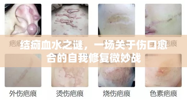 結(jié)痂血水之謎，一場關(guān)于傷口愈合的自我修復(fù)微妙戰(zhàn)