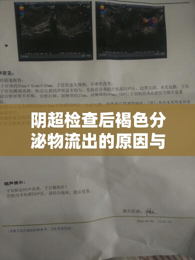 陰超檢查后褐色分泌物流出的原因與應(yīng)對措施