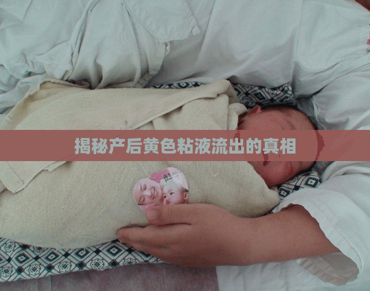 揭秘產(chǎn)后黃色粘液流出的真相