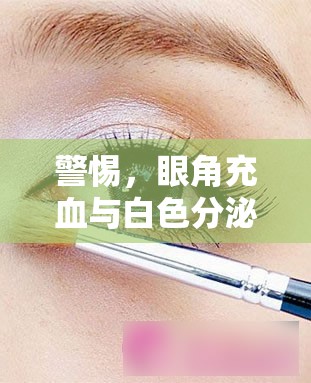 警惕，眼角充血與白色分泌物——眼部健康的警報信號