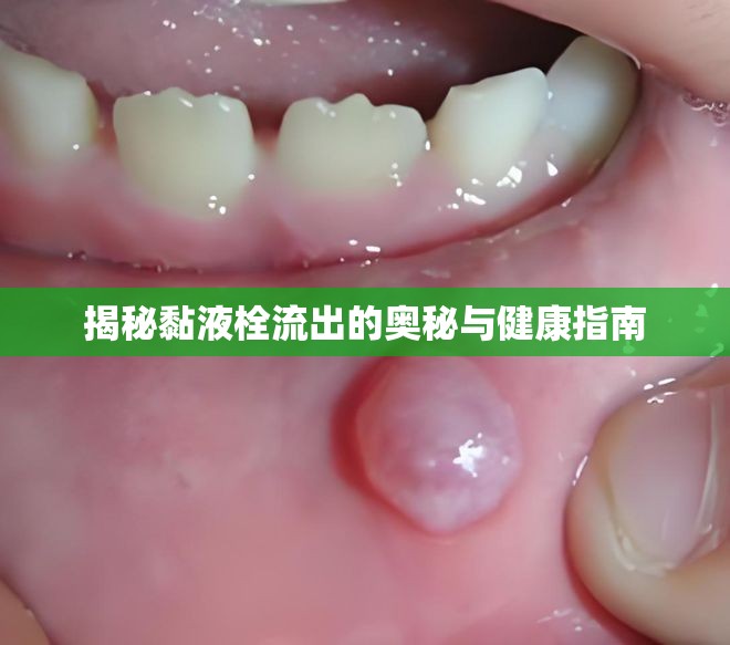 揭秘黏液栓流出的奧秘與健康指南