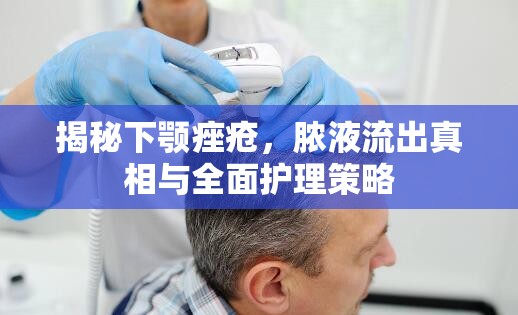 揭秘下顎痤瘡，膿液流出真相與全面護(hù)理策略