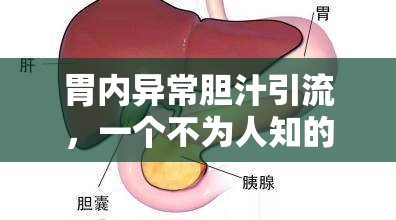 胃內(nèi)異常膽汁引流，一個(gè)不為人知的健康警報(bào)