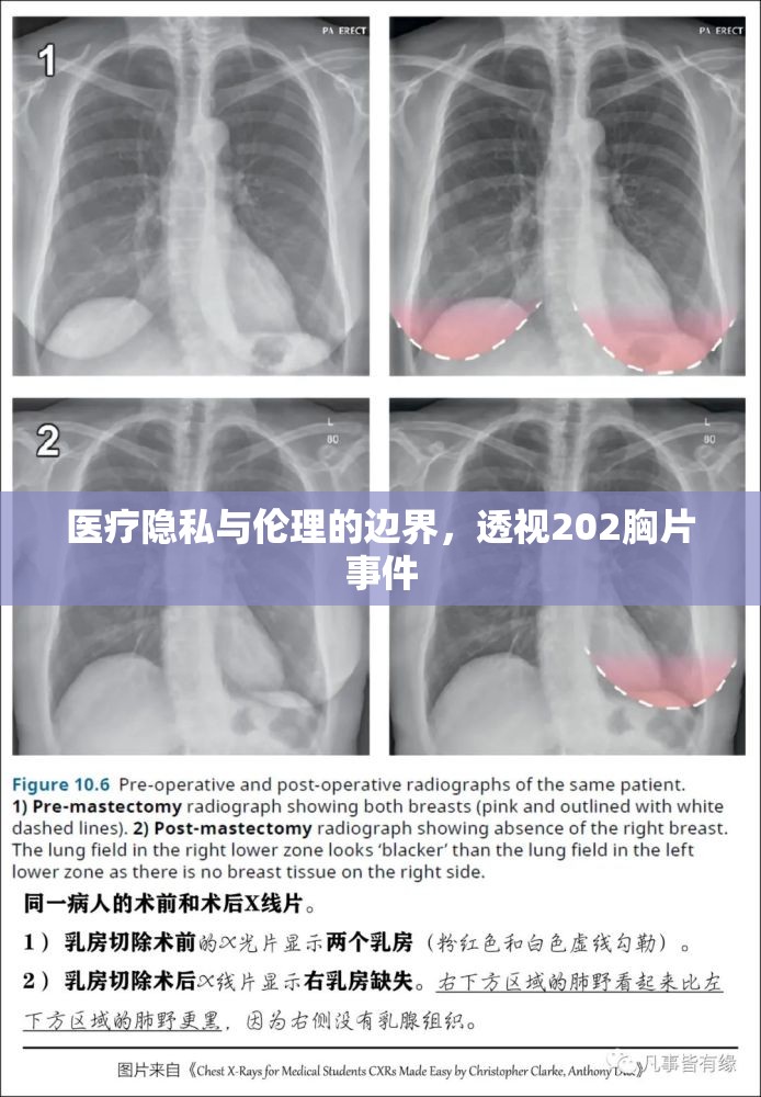 醫(yī)療隱私與倫理的邊界，透視202胸片事件