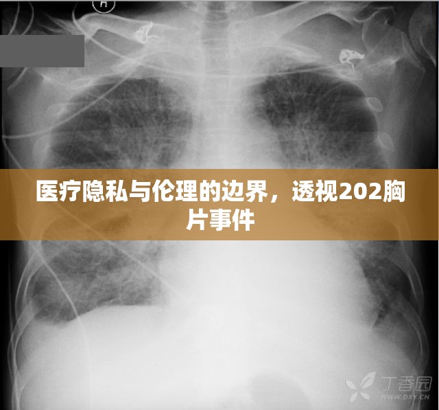 醫(yī)療隱私與倫理的邊界，透視202胸片事件