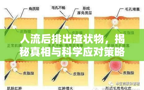 人流后排出渣狀物，揭秘真相與科學(xué)應(yīng)對(duì)策略