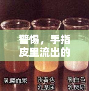 警惕，手指皮里流出的黃色液體可能是健康警報