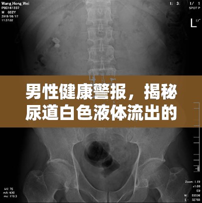 男性健康警報，揭秘尿道白色液體流出的真相