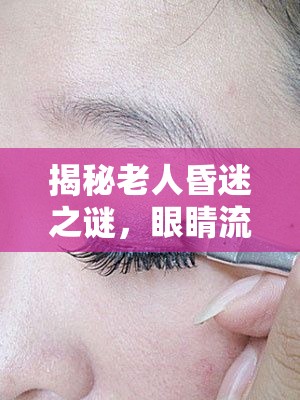 揭秘老人昏迷之謎，眼睛流膿背后的真相