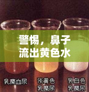 警惕，鼻子流出黃色水樣液體或?yàn)闈撛诮】敌盘? class=