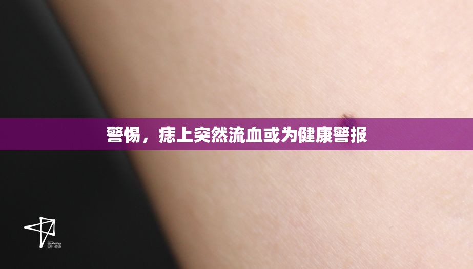 警惕，痣上突然流血或為健康警報