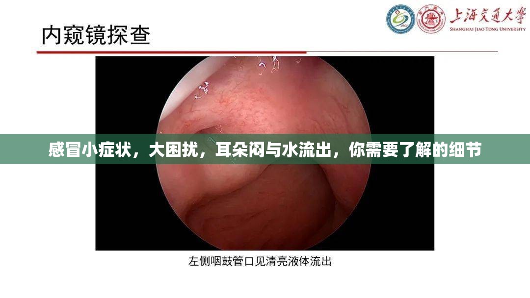 感冒小癥狀，大困擾，耳朵悶與水流出，你需要了解的細節(jié)