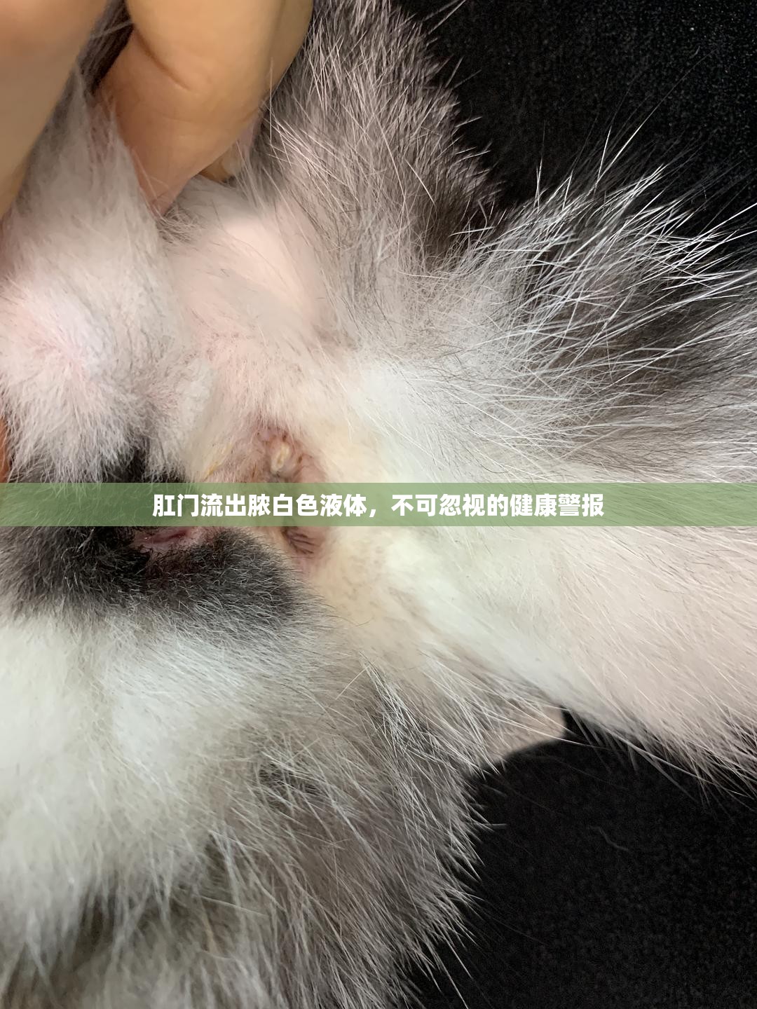 肛門流出膿白色液體，不可忽視的健康警報(bào)