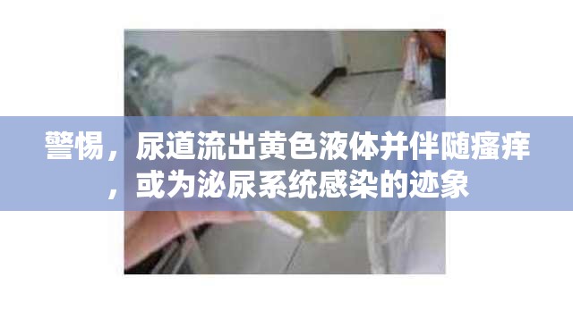 警惕，尿道流出黃色液體并伴隨瘙癢，或為泌尿系統(tǒng)感染的跡象