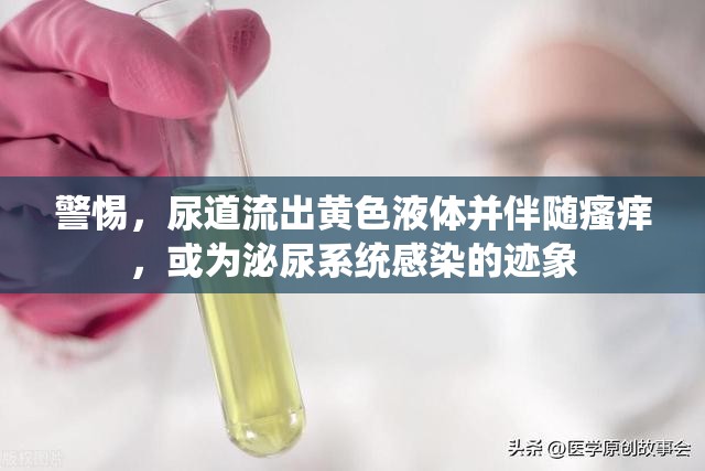 警惕，尿道流出黃色液體并伴隨瘙癢，或為泌尿系統(tǒng)感染的跡象