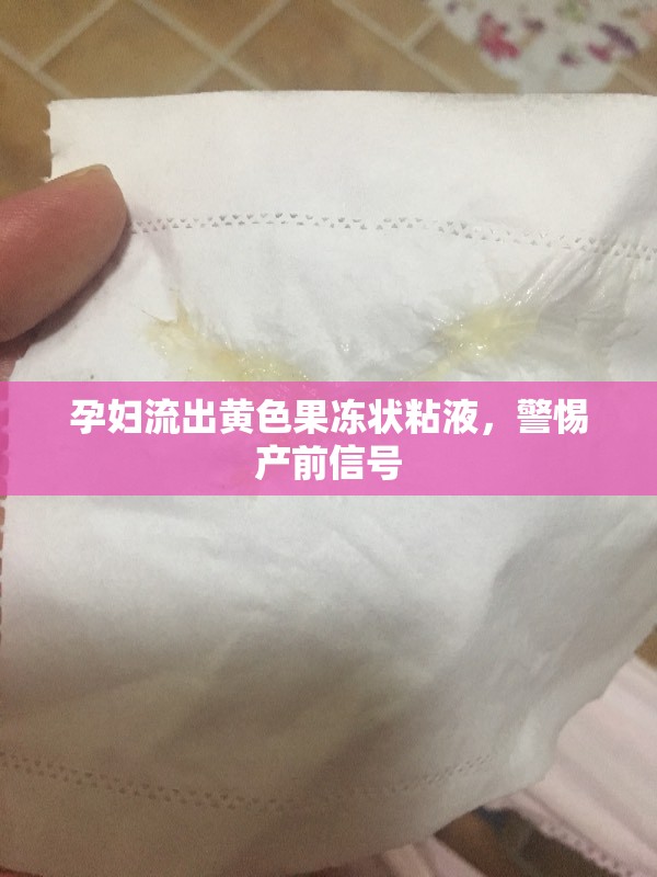 孕婦流出黃色果凍狀粘液，警惕產(chǎn)前信號(hào)