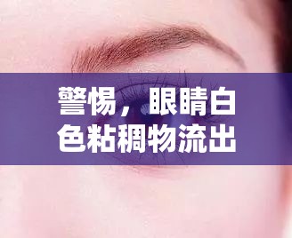 警惕，眼睛白色粘稠物流出或?yàn)檠鄄拷】惦[形信號(hào)