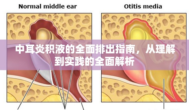 中耳炎積液的全面排出指南，從理解到實踐的全面解析
