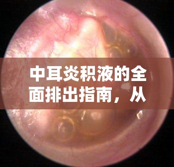 中耳炎積液的全面排出指南，從理解到實踐的全面解析
