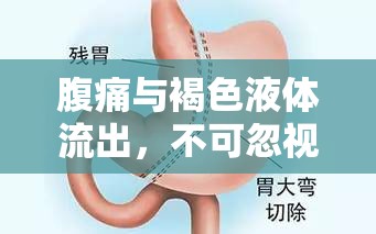 腹痛與褐色液體流出，不可忽視的健康警報(bào)
