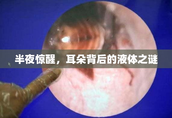 半夜驚醒，耳朵背后的液體之謎