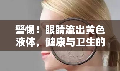 警惕！眼睛流出黃色液體，健康與衛(wèi)生的雙重警示
