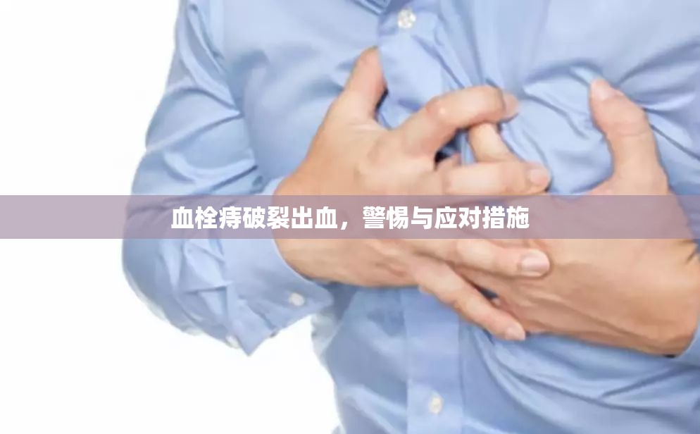 血栓痔破裂出血，警惕與應(yīng)對措施