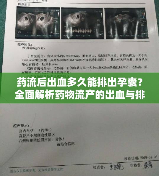 藥流后出血多久能排出孕囊？全面解析藥物流產(chǎn)的出血與排囊過(guò)程