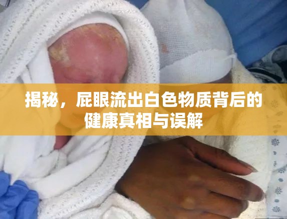 揭秘，屁眼流出白色物質(zhì)背后的健康真相與誤解