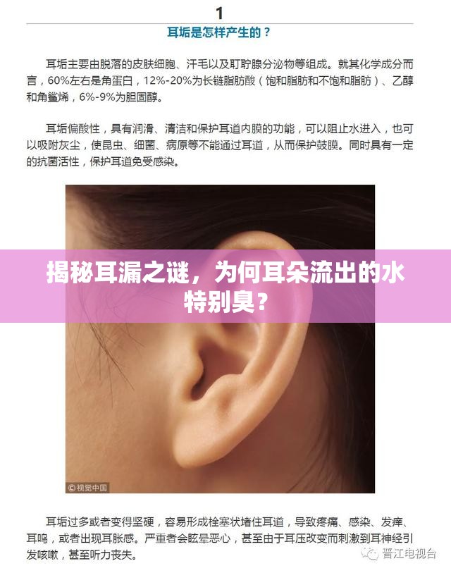 揭秘耳漏之謎，為何耳朵流出的水特別臭？