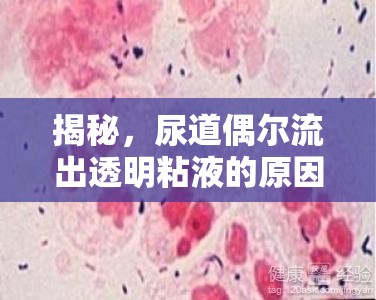 揭秘，尿道偶爾流出透明粘液的原因