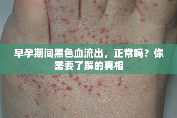 早孕期間黑色血流出，正常嗎？你需要了解的真相