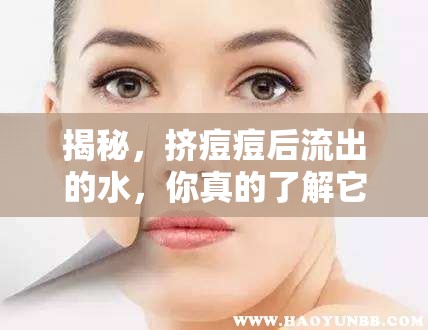 揭秘，擠痘痘后流出的水，你真的了解它的真相嗎？