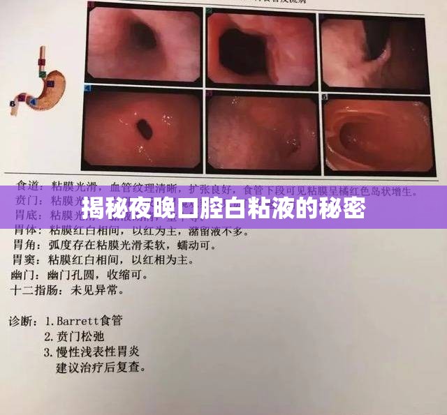 揭秘夜晚口腔白粘液的秘密