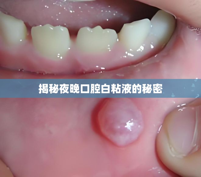 揭秘夜晚口腔白粘液的秘密