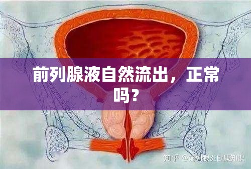 前列腺液自然流出，正常嗎？