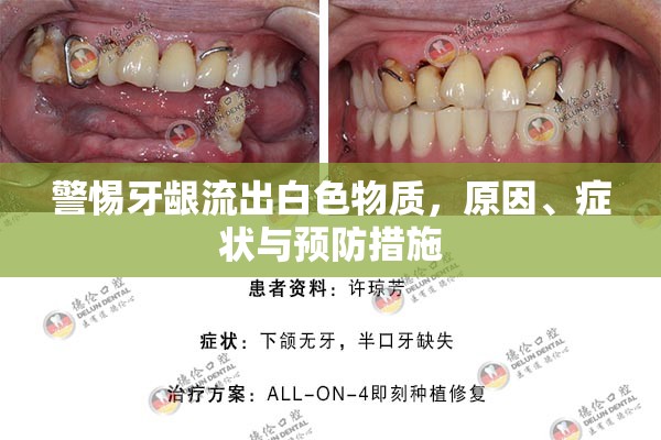 警惕牙齦流出白色物質(zhì)，原因、癥狀與預(yù)防措施