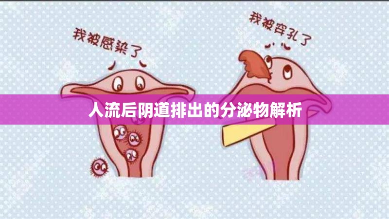 人流后陰道排出的分泌物解析