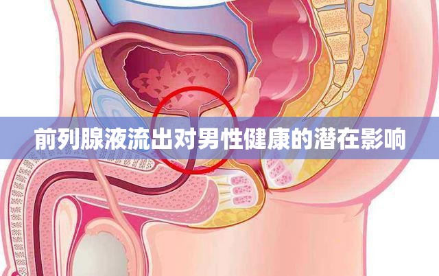 前列腺液流出對(duì)男性健康的潛在影響