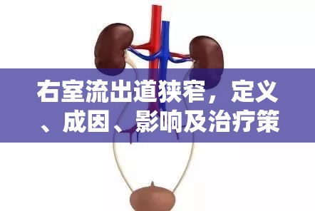 右室流出道狹窄，定義、成因、影響及治療策略