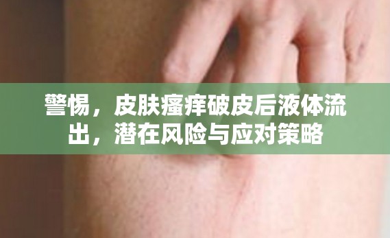 警惕，皮膚瘙癢破皮后液體流出，潛在風(fēng)險(xiǎn)與應(yīng)對策略