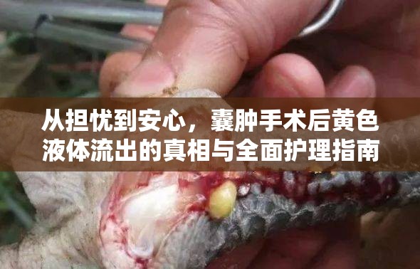 從擔(dān)憂到安心，囊腫手術(shù)后黃色液體流出的真相與全面護(hù)理指南