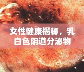 女性健康揭秘，乳白色陰道分泌物，你真的了解嗎？