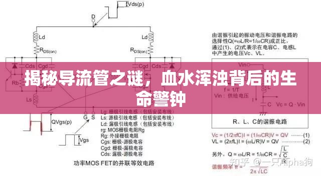 揭秘導流管之謎，血水渾濁背后的生命警鐘