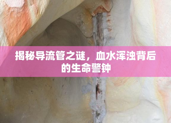 揭秘導流管之謎，血水渾濁背后的生命警鐘
