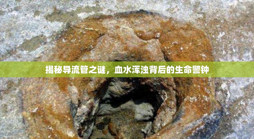 揭秘導流管之謎，血水渾濁背后的生命警鐘