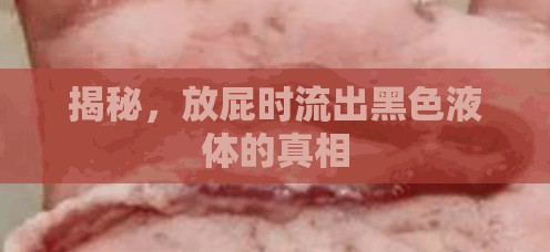 揭秘，放屁時(shí)流出黑色液體的真相