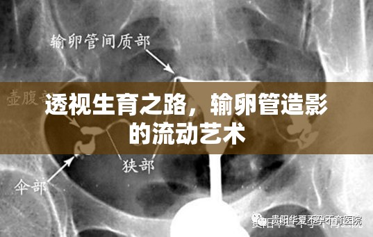 透視生育之路，輸卵管造影的流動(dòng)藝術(shù)