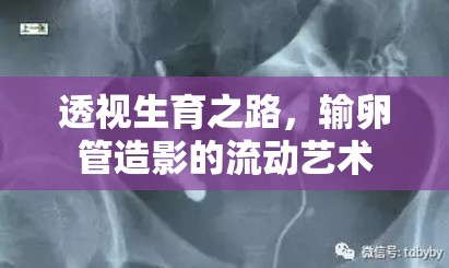 透視生育之路，輸卵管造影的流動(dòng)藝術(shù)