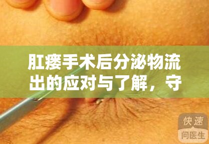 肛瘺手術(shù)后分泌物流出的應(yīng)對與了解，守護術(shù)后康復(fù)的秘密